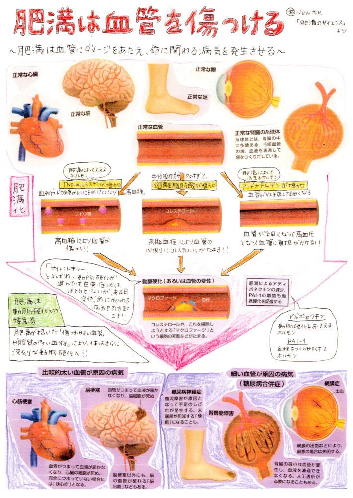 （Vol.11）肥満は血管を傷つける